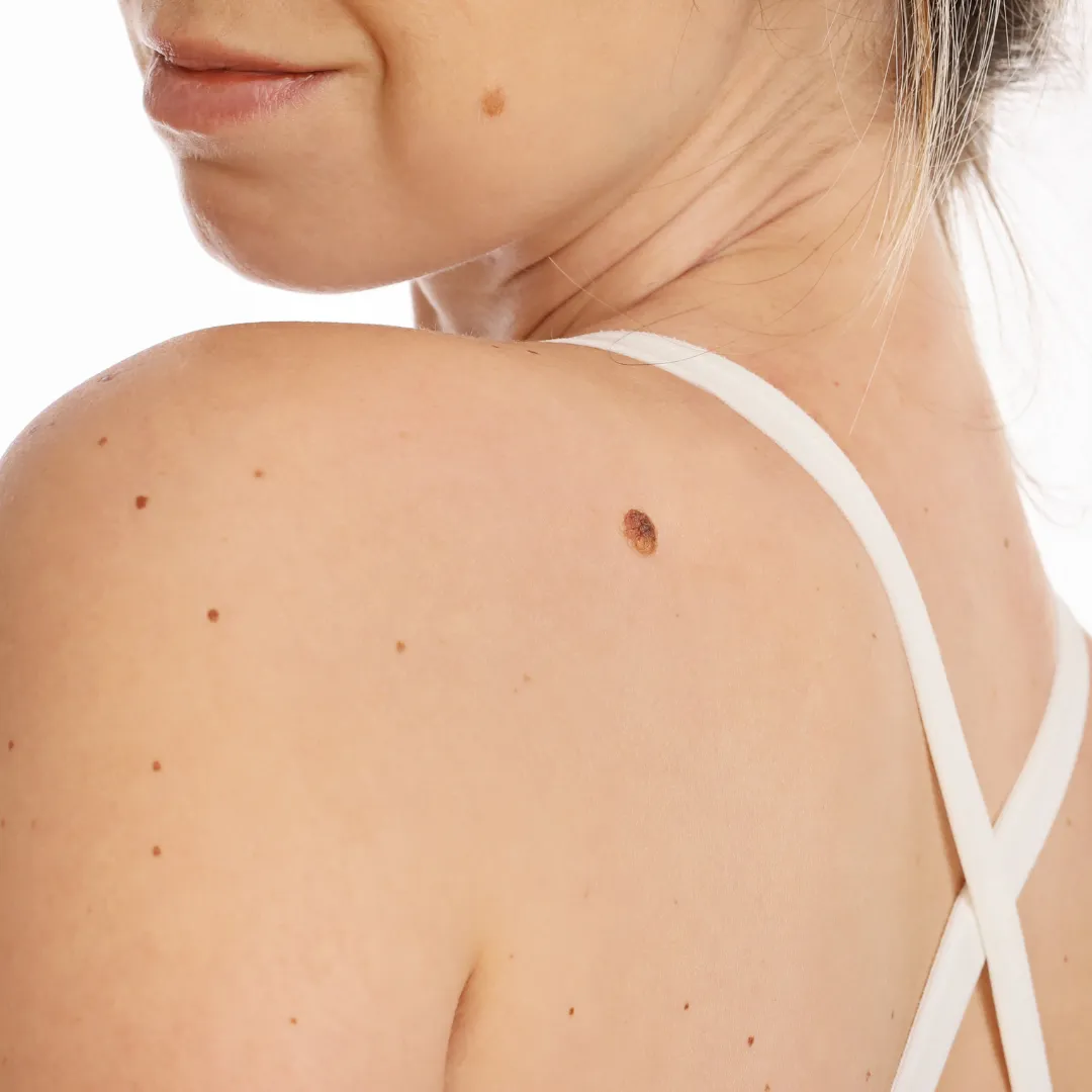 Kissed Peach Skin Tag