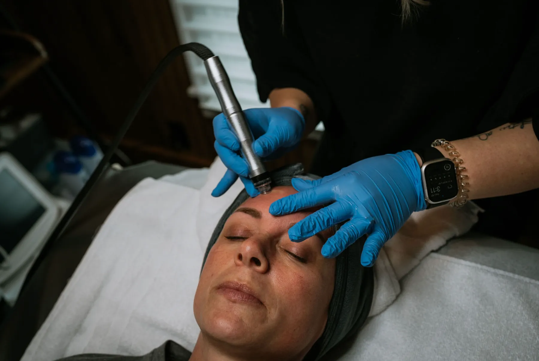 HydraFacial Treatment in Waukee, IA | The Kissed Peach