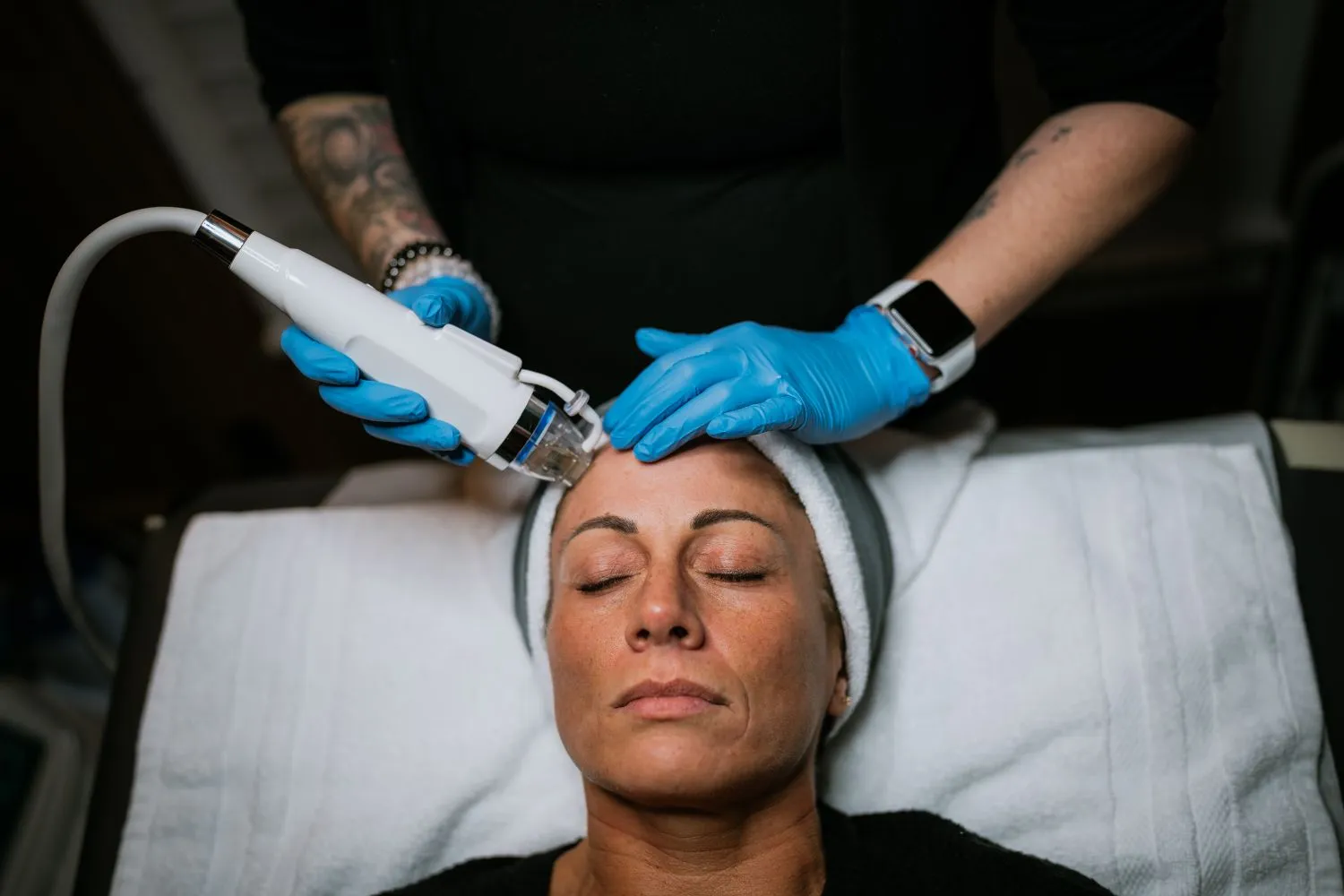 Rejuvenation Radiofrequency Microneedling in Waukee, IA
