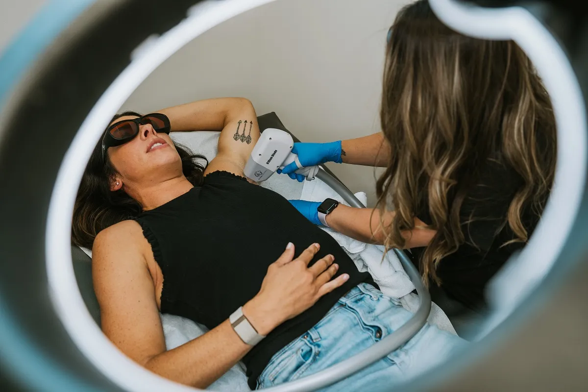 Laser Hair Removal in Waukee, IA at The Kissed Peach